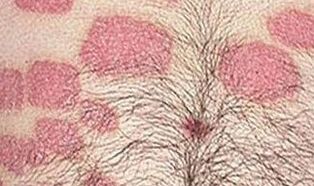Multiple pink formations in the abdomen